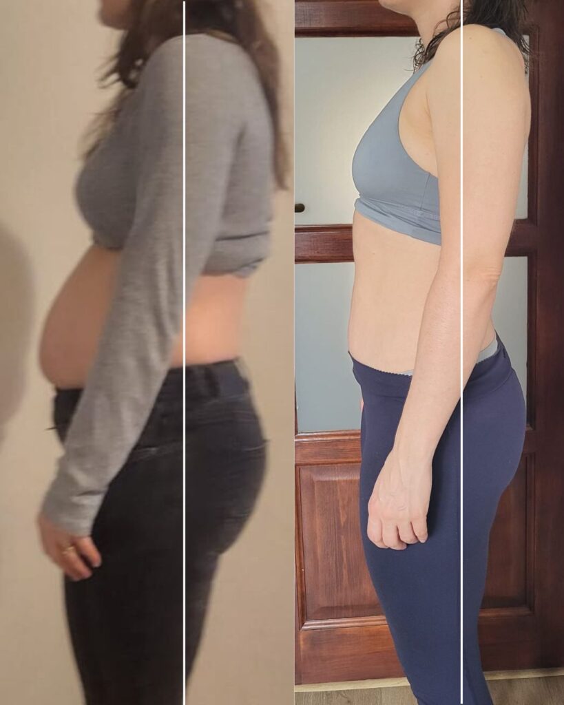 Metamorfoza wystający brzuch