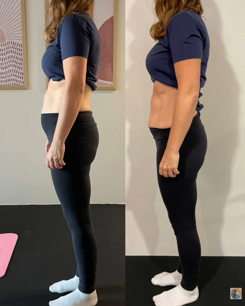 Metamorfoza Klientki - Ćwiczyła 2 lata. Brzuch po ciąży dalej wystawał – dlaczego?